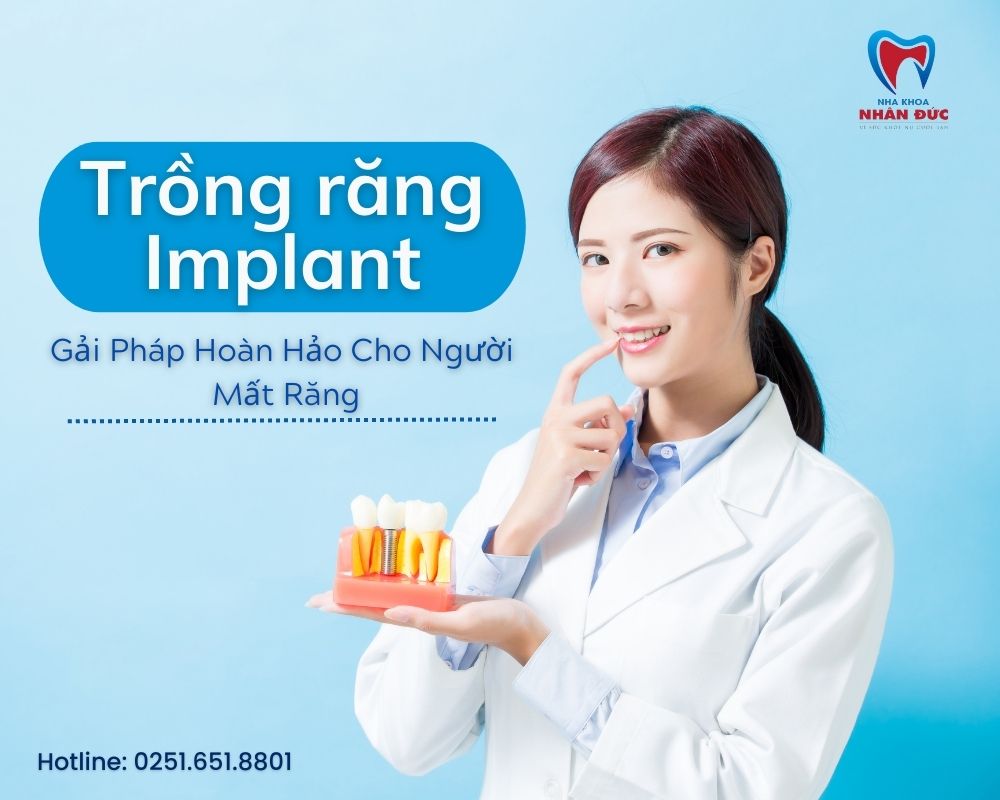 Trồng Răng Implant tại Long Thành