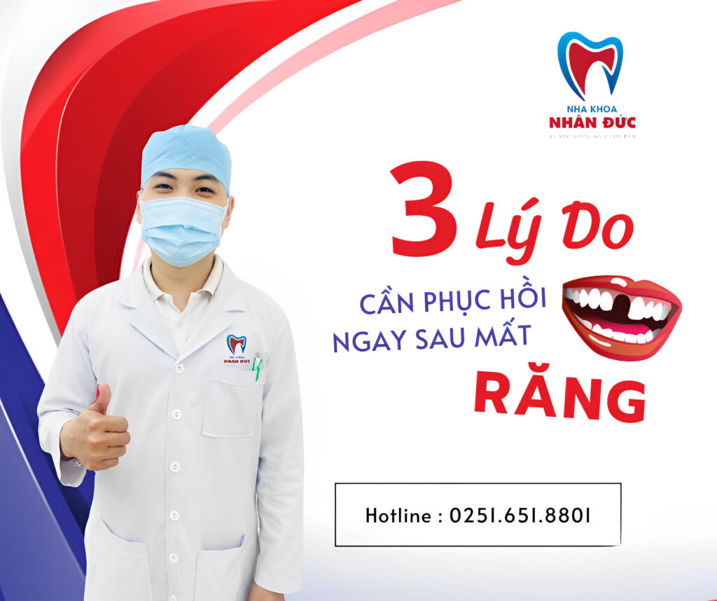 3 Lý do cần phục hồi ngay sau khi mất răng